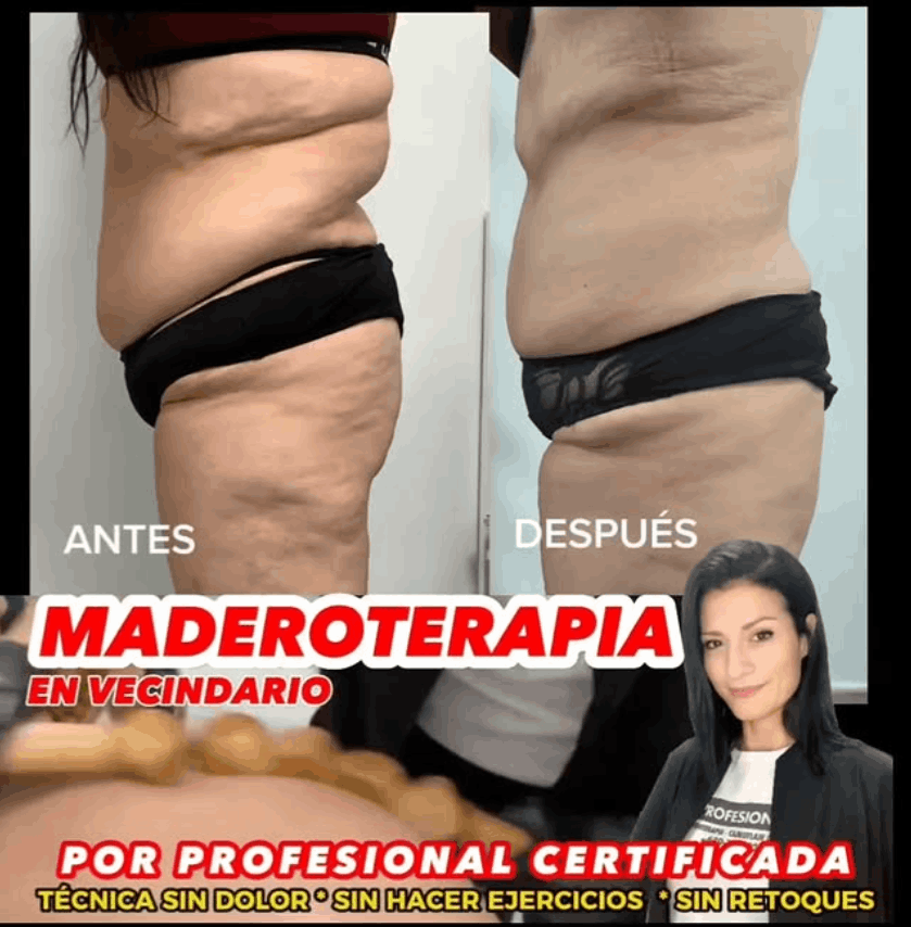 maderoterapia antes y despues