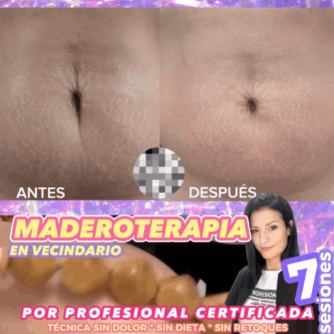 Maderoterapia antes y despues