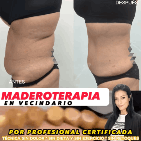 Maderoterapia antes y despues