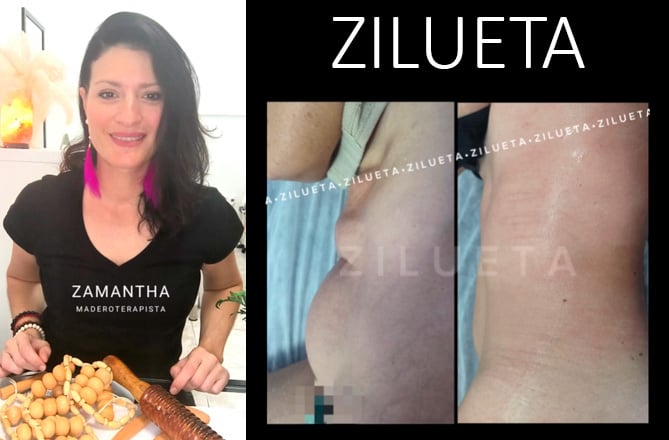 Maderoterapia en Las Palmas